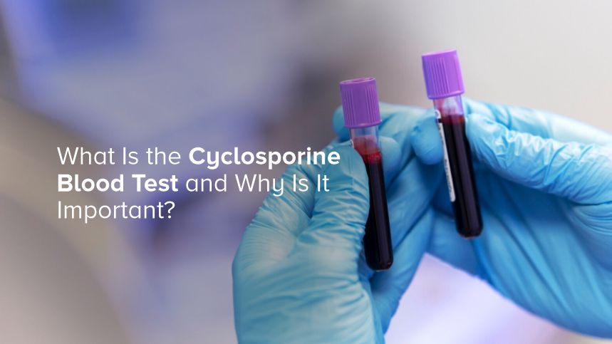 What Is the Cyclosporine Blood Test and Why Is It Important?